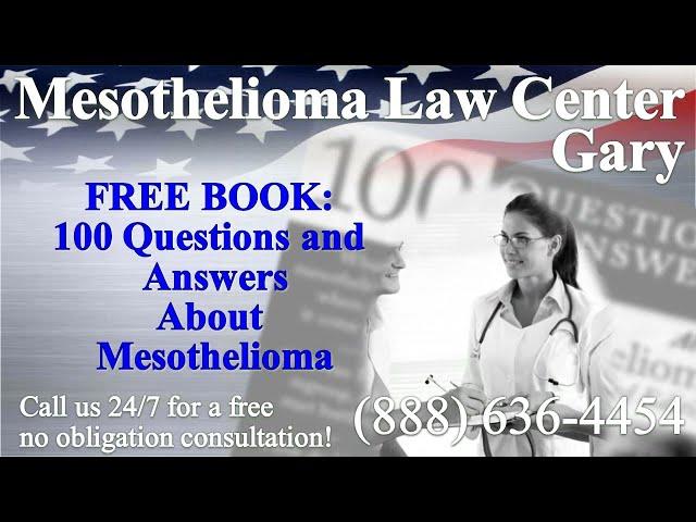 Gary, IN - Mesothelioma & Asbestos - Lawyer | Attorney | Lawsuit - (Lung Cancer, Asbestosis)