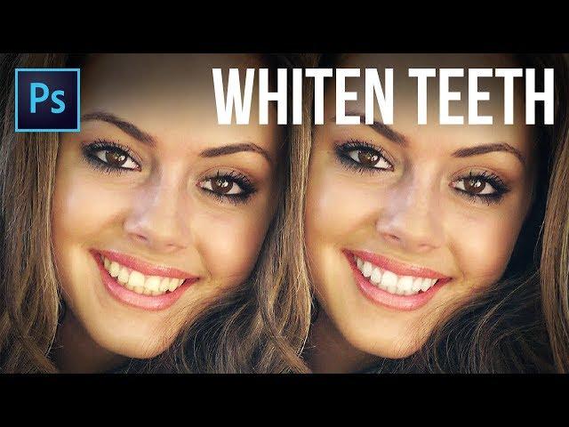 3 Super Realistic Techniques to Whiten Teeth in Photoshop