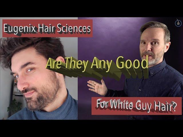 How is Eugenix Hair Sciences With Caucasian Hair Transplants?