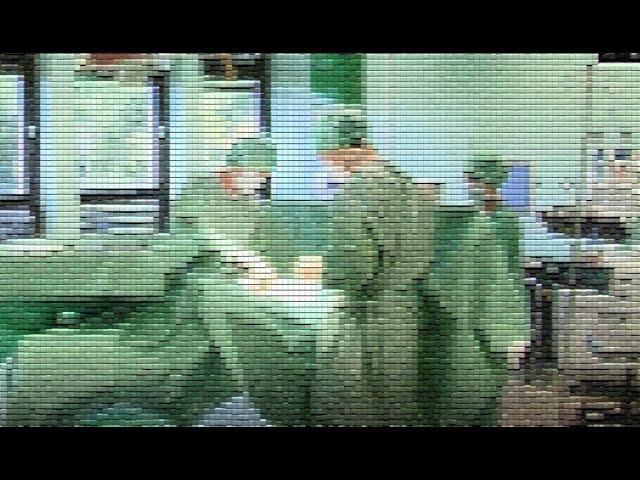 Bilateral orchiectomy; surgical removal of both testicles