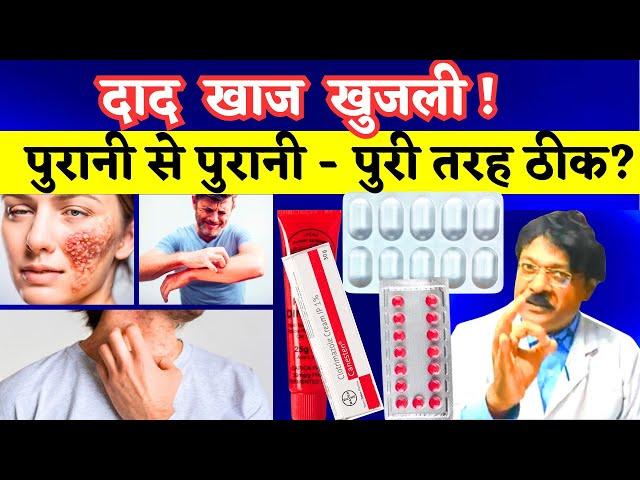 Dad Khaj Khujli Ki Dawa | दाद खाज खुजली को जड़ से कैसे ठीक करें | 3 Best Medicine For Dad Khaj Khujli