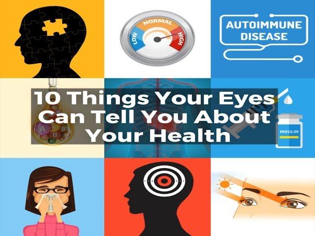 10 Things Your Eyes Can Tell You About Your Health