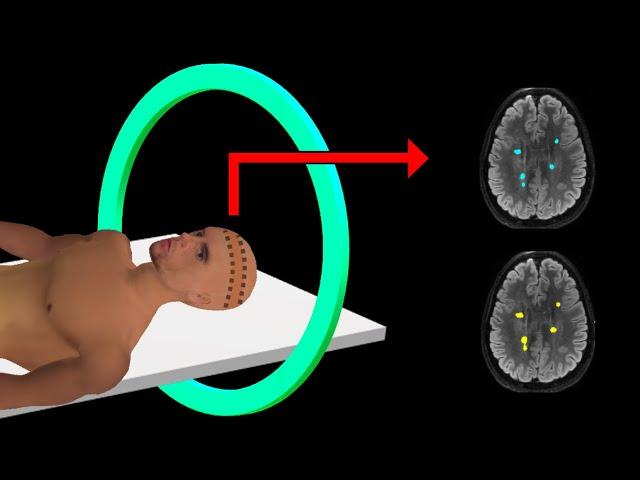 PET Scan | How It Works | Animation