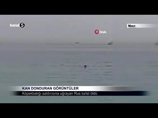 Kan Donduran Görüntüler / Köpekbalığı Saldırısına Uğrayan Rus turist Öldü