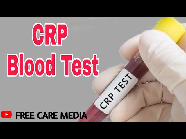 CRP test in malayalam