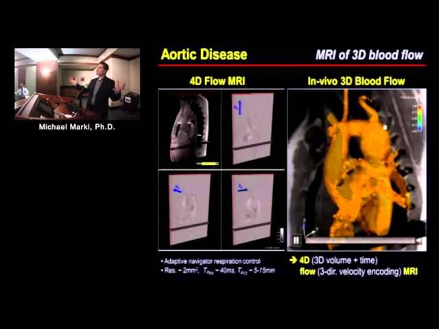 Recent Advances in Cardiovascular Magnetic Resonance Imaging (Michael Markl, Ph.D.) Nov. 19, 2015