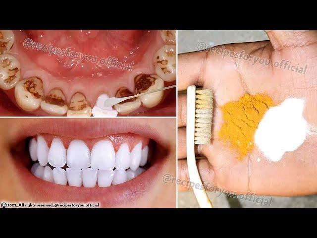 Secret that Dentists don't want you to know: Remove Tartar and Teeth Whitening in just 2 minutes