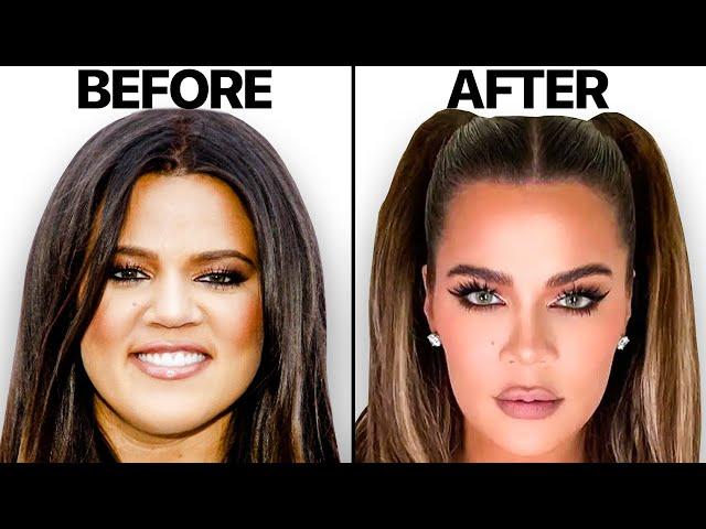 Khloe Kardashian NEW Face | Plastic Surgery Analysis