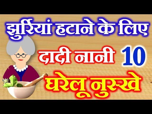 10 Home Remedies for Wrinkles on Face | दादी नानी घरेलू नुस्खे | Jurriyo ke Liye Gharelu Upay