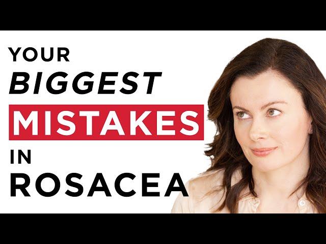 How To Treat Rosacea: What NOT To Do & The BIGGEST Rosacea Mistakes | Dr Sam Bunting