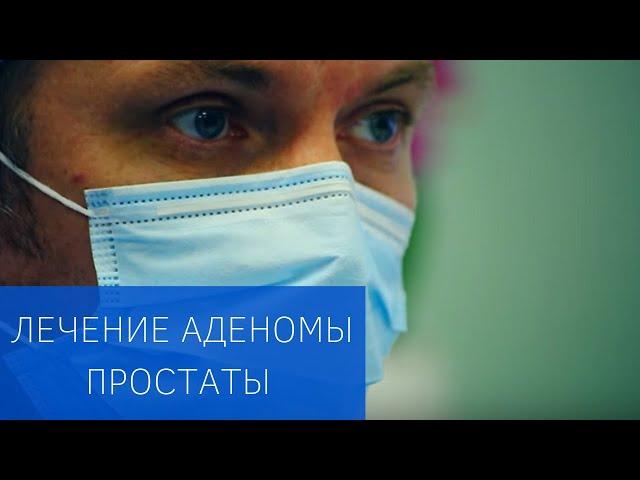 Эмболизация простатических артерий