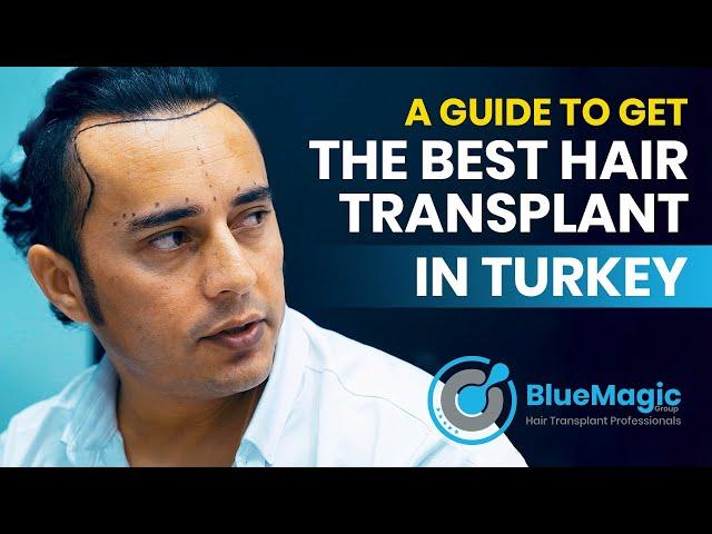 A Guide to get The BEST Hair Transplant in Turkey | BlueMagic Group Clinic