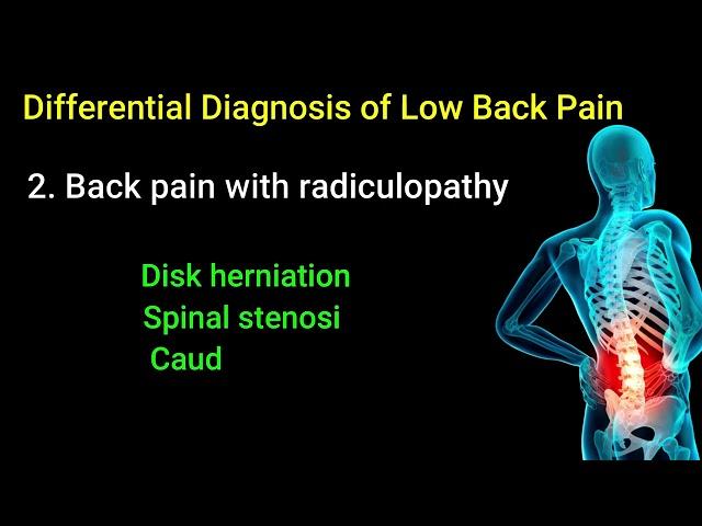 Differential Diagnosis of Low Back Pain (Clinical Help): What You Should Know