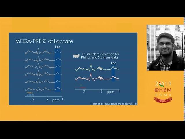 OHBM 2019: Muhammad Saleh