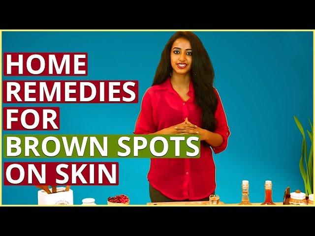 3 Easy Home Remedies To REMOVE BROWN SPOTS ON FACE & SKIN