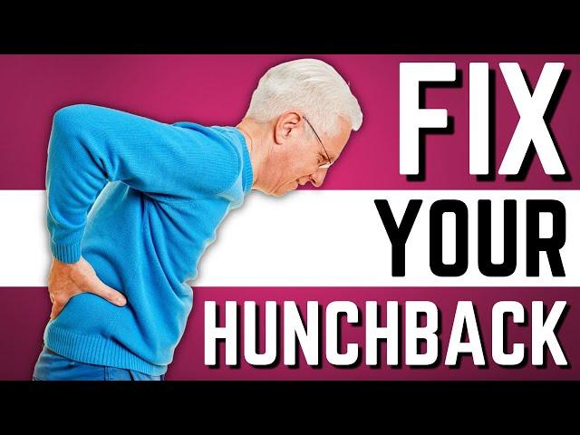 Top 10 Exercises to Stop Hunchback, Kyphosis, Forward Head Posture