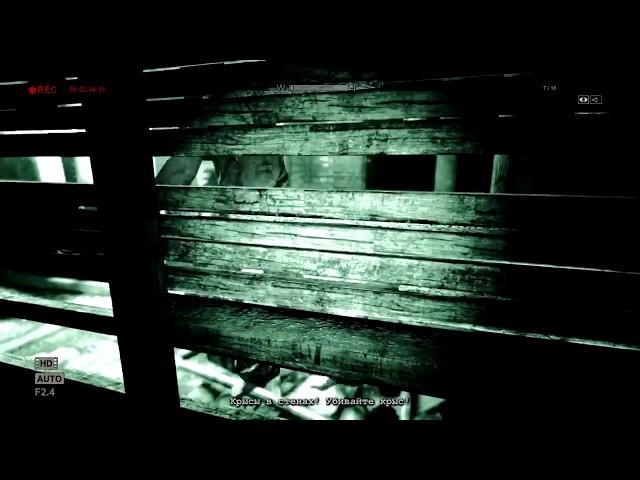 ЖЕСТЬ Ампутация Члена Outlast Whistleblower #7