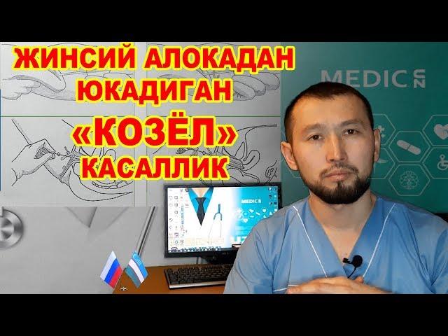 #MEDICUZ #VENEROLOG #DOCTORSPB Жинсий алокадан юкадигон Соткин "КОЗЁЛ" касалик