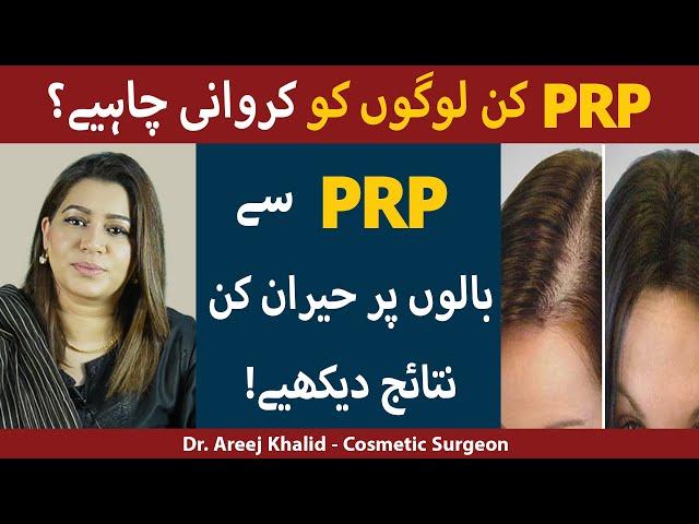 PRP Treatment for Hair Loss | PRP Results | PRP Cost | PRP Session For Hair Loss