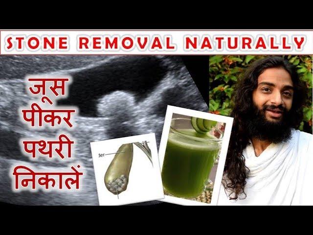 Homemade Vegetable Drink to Remove Stone -  Gall bladder & Kidney Stone