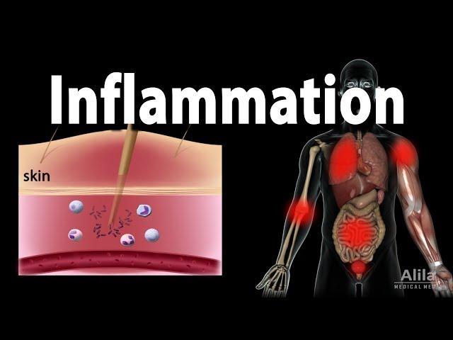 Inflammatory Response, Animation