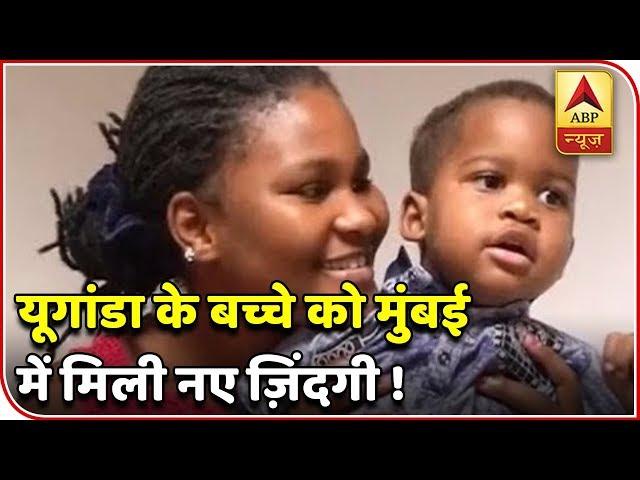 Mumbai Doctors Cure Uganda Child Suffering From Sturge Weber Syndrome | ABP News