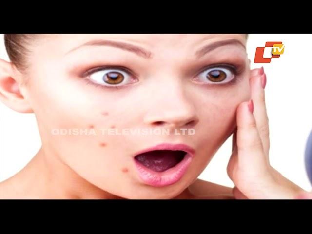 STAY FIT | Prp Treatment |The Secret To Younger Looking Skin |No Sugar Diet | Health Benefits