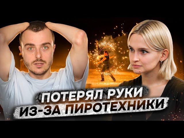 ‎«Пальцы разлетелись по всей округе» | Костя Бионическая Россия