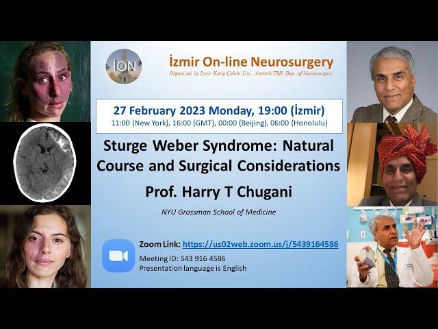 ION 324. ZOOM lecture Chugani: Sturge Weber Syndrome  27.02.23