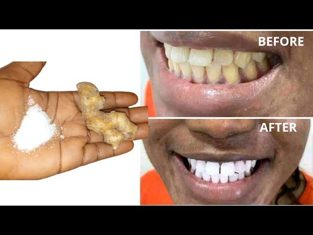 Whiten Your Teeth In Just Two Minutes