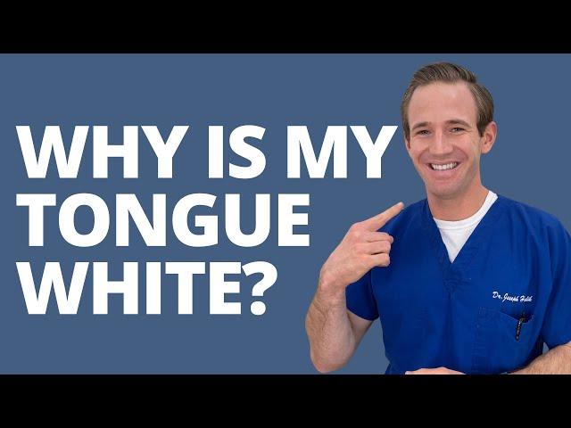 ASK DR. H - WHY IS MY TONGUE WHITE?