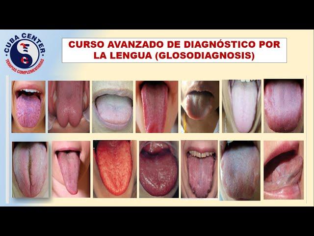 CURSO AVANZADO DE DIAGNÓSTICO POR LA LENGUA