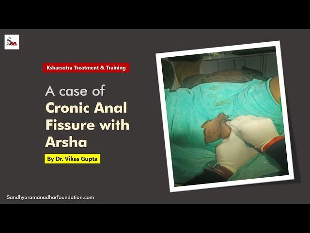 A case of Cronic Anal Fissure with Arsha | Dr. Vikas Gupta | Sandhya Raman Adhar Foundation