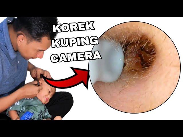 review korek kuping Erwax removal tool brexia