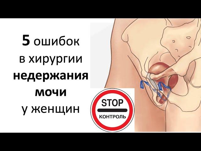 Путь к осложнениям в хирургическом лечении недержания мочи у женщин