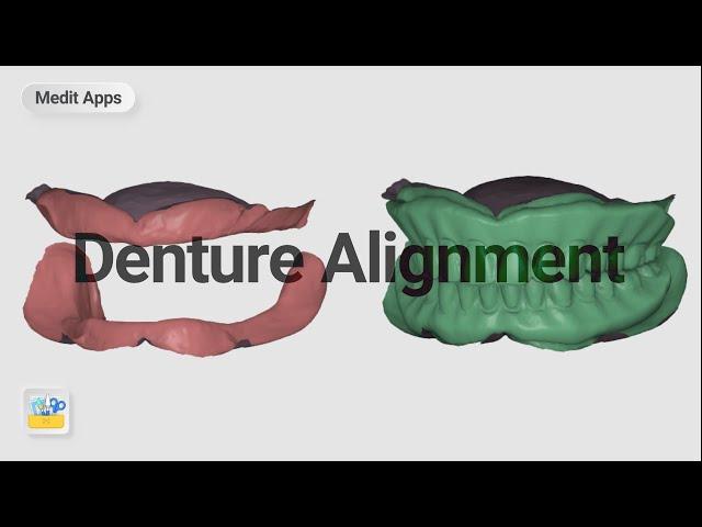How to align edentulous and denture scan data