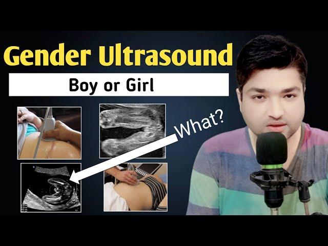 How to Find Gender in Ultrasound by Dr Ali Waqar  | Gender Ultrasound