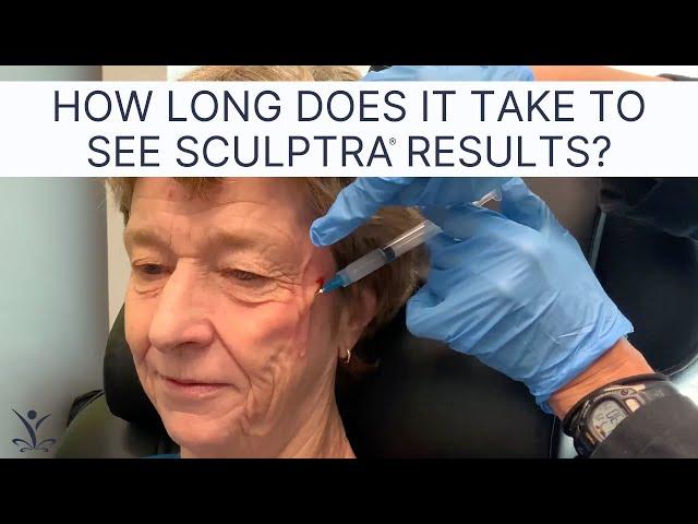 Sculptra Injections | How is Sculptra Different From Dermal Fillers?