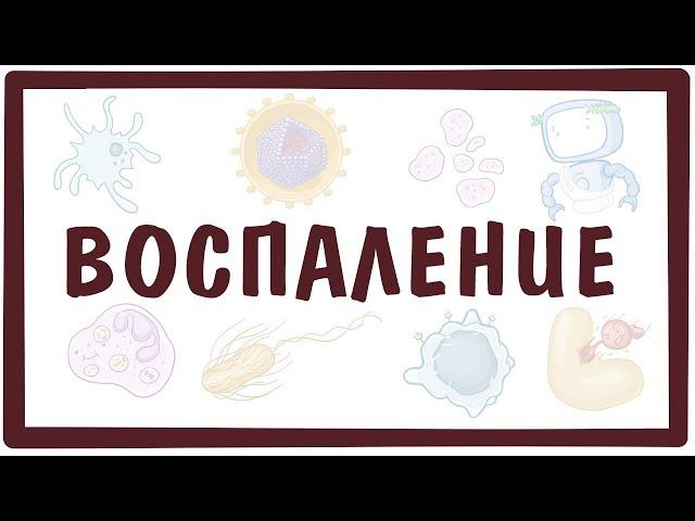 ВОСПАЛЕНИЕ — причины, симптомы, патогенез