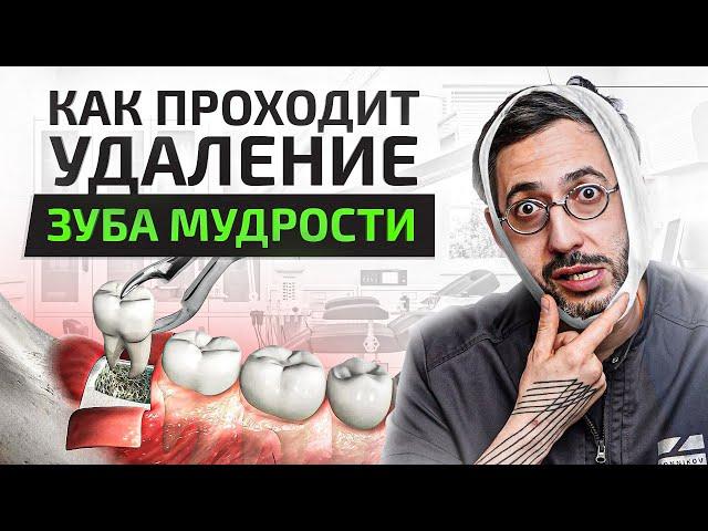 Как проходит удаление зуба мудрости. Первые 7 дней после удаления