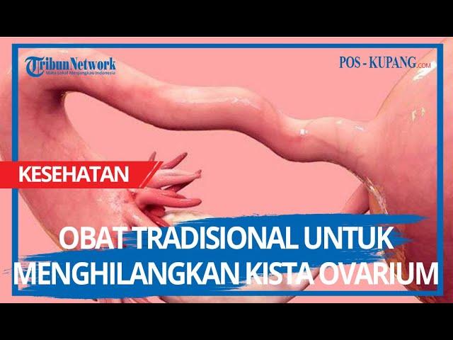 Obat Tradisional Untuk Menghilangkan Kista Ovarium