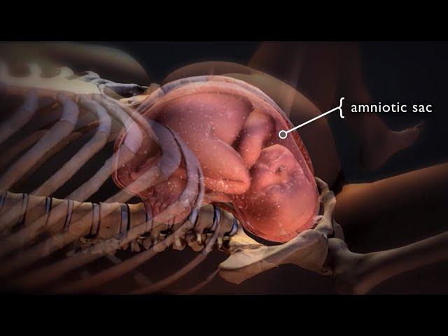 Early Water Breaks in Pregnancy |Amniotic Sack Breaks |