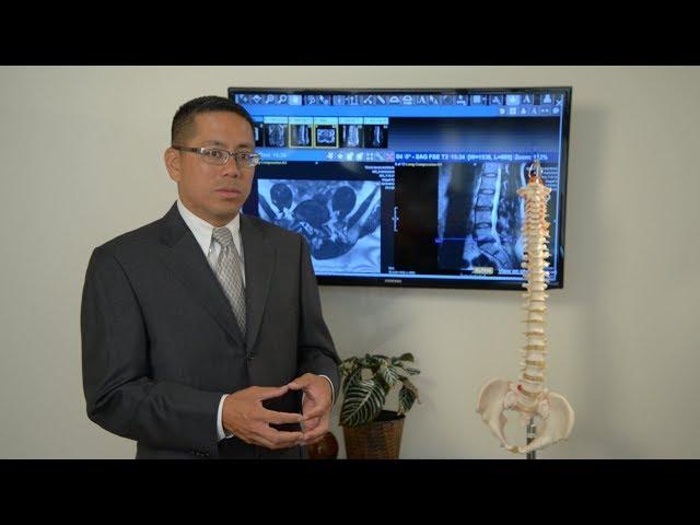 What is a Herniated Disc? Symptoms & Treatment Options Explained by Dr. Rey Bosita