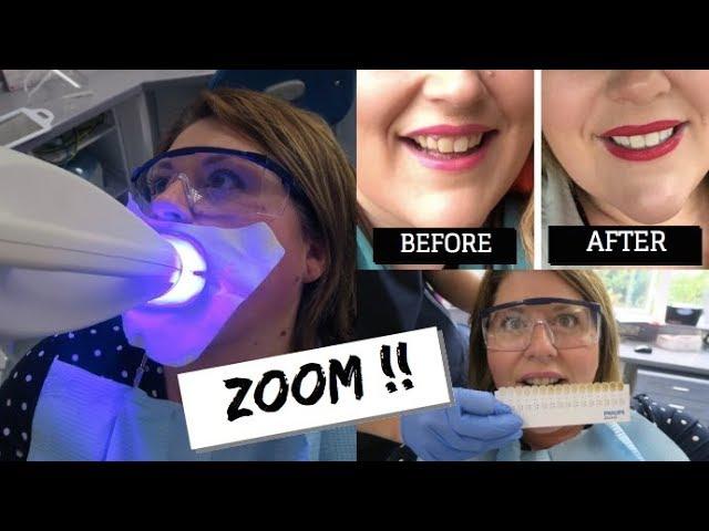 TEETH WHITENING - DOES IT WORK?  / ZOOM WHITENING