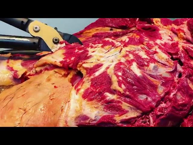 Opening the Rib Cage at Autopsy