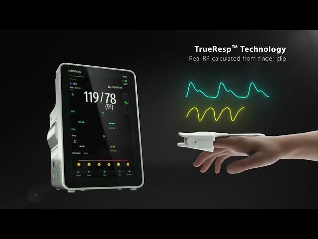 Mindray VS Series: Elevate Patient Care with Precision and Efficiency