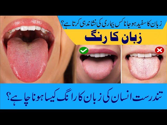 What Is White Tongue? | White Tongue Treatment | Zuban Ka Safed Hona Urdu | #trending #shortsvideo