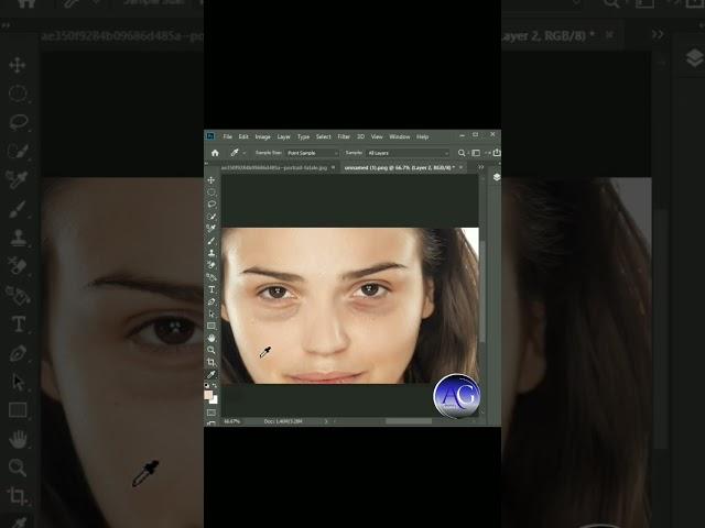 How to Remove Dark Circles Around the Eyes in Photoshop #darkcircles