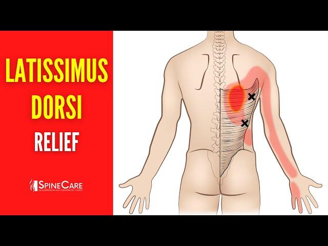 How to Fix Latissimus Dorsi Muscle Pain FOR GOOD