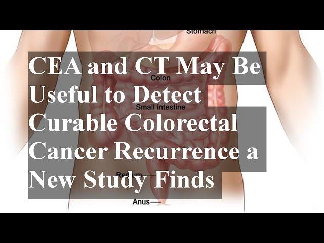 CEA and CT May Be Useful to Detect Curable Colorectal Cancer Recurrence a New Study Finds